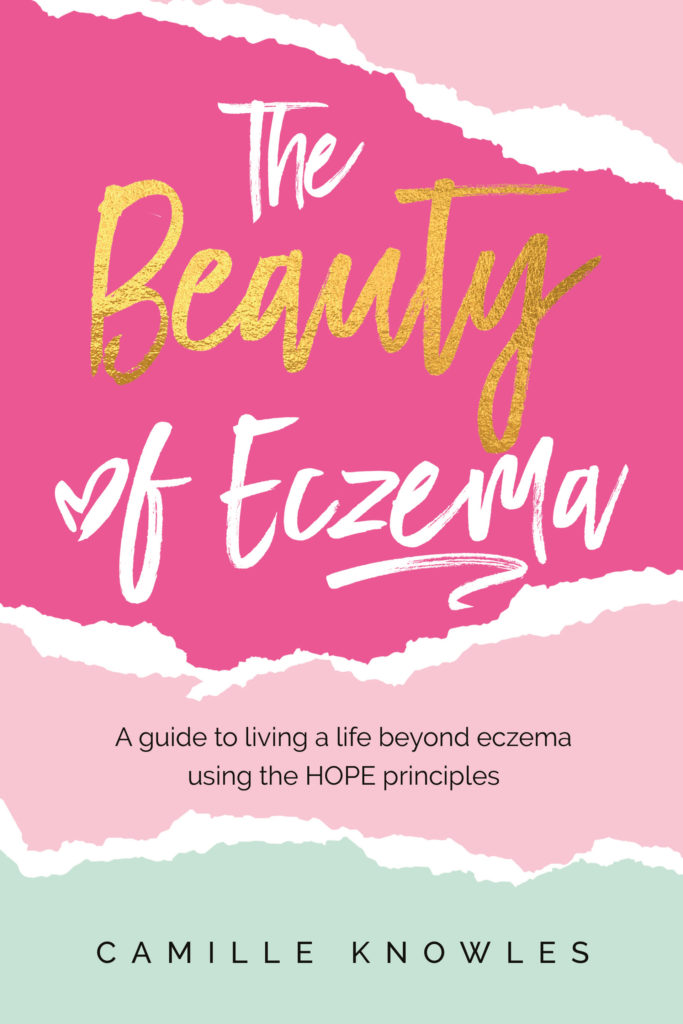 The Beauty of Eczema by Camille Knowles