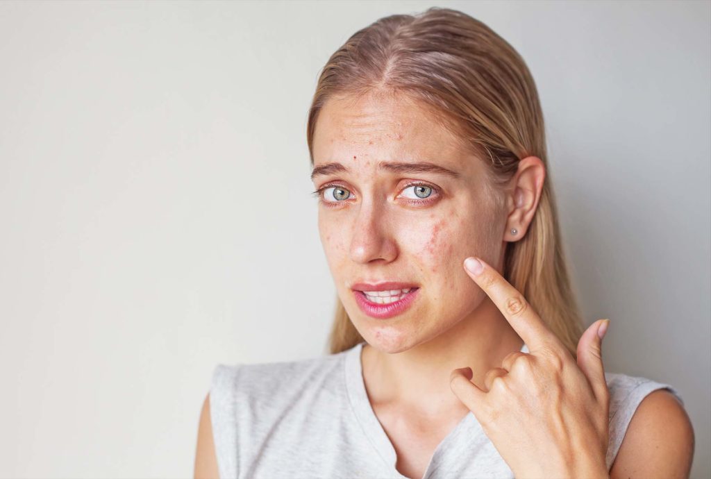 woman with allergy on her face